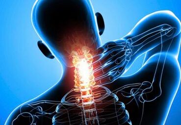 intensīvas kakla sāpes ar progresējošu osteohondrozi