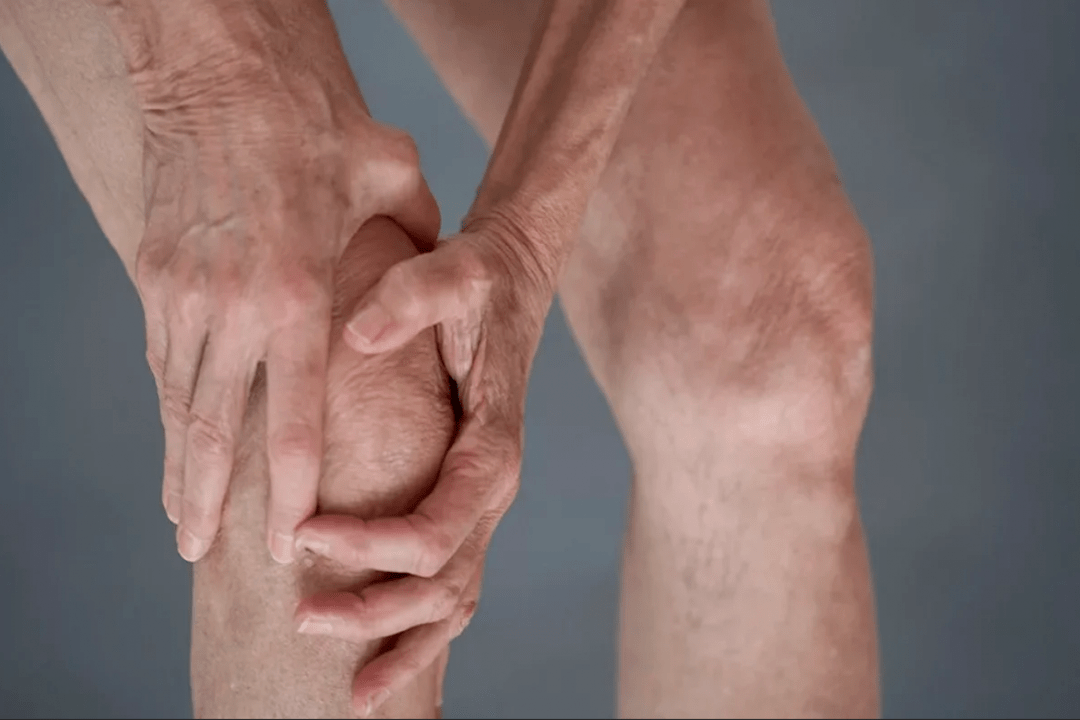 locītavu sāpes var būt artrozes vai artrīta cēlonis