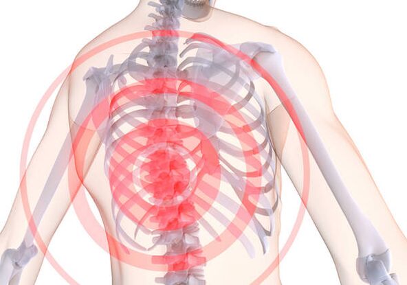Torakālo osteohondrozi pavada dorsago - akūtas sāpes, kas ierobežo muskuļus