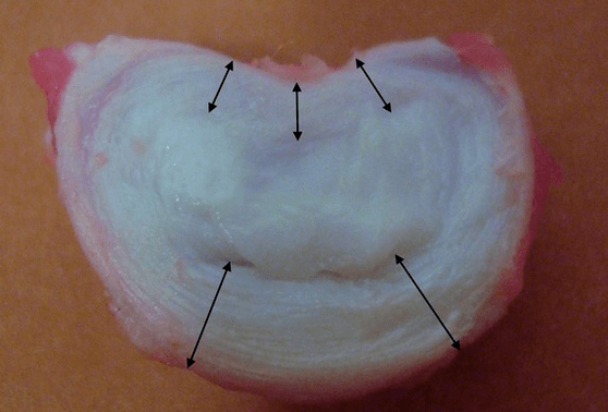 kā izskatās starpskriemeļu disks