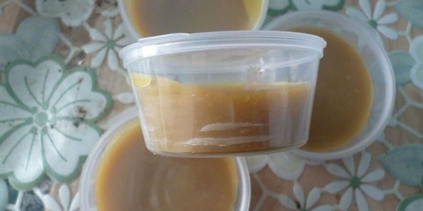 mājās gatavota ziede osteohondrozes ārstēšanai