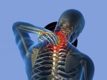 Cilvēku ar mugurkaula kakla daļas osteohondrozi nomoka kakla sāpes
